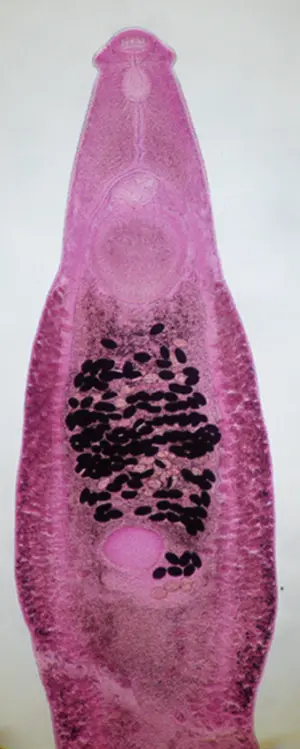 Adult Echinostoma cinetorchis