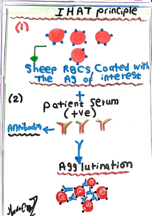 Serology in Toxoplasmosis 2: IHAT Test
