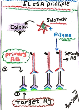 Serology in Toxoplasmosis 1: ELISA Test