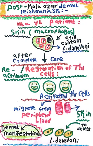 Post-Kala Azar Dermal Leishmaniasis: Marwa Omar