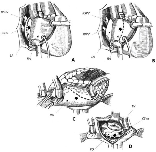 Jcm 11 03323 g001 550