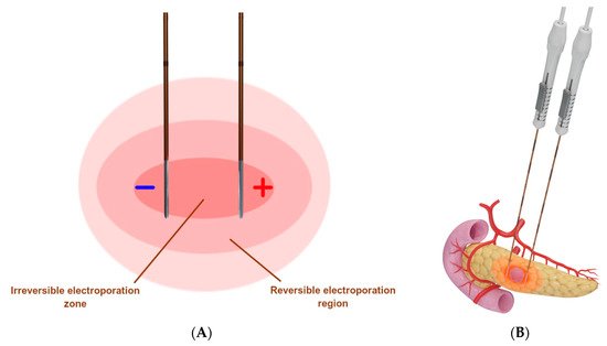 Diagnostics 12 01300 g005 550