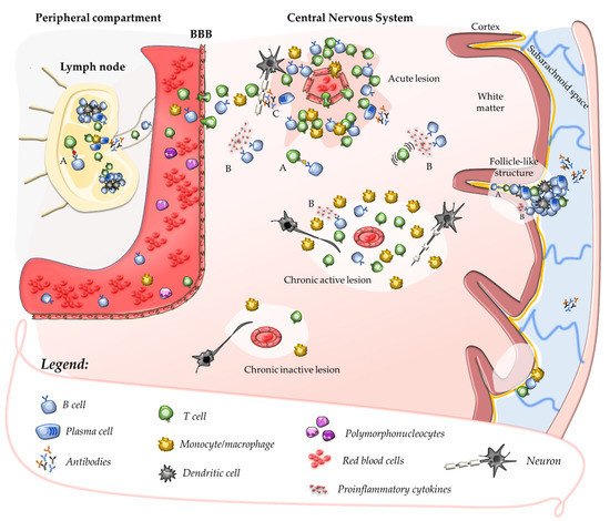 Pathogenesis In Multiple Sclerosis And B Cell Depletion | Encyclopedia MDPI