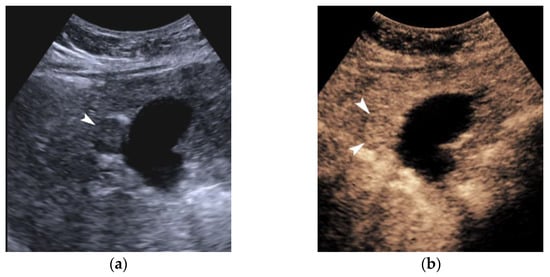 Cancers 14 03997 g003 550