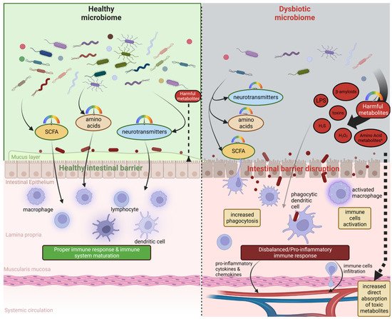 Connection between GUT Metabolome and Neurological Disorders ...