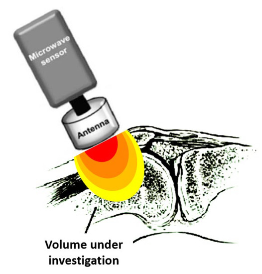 Diagnostics 13 00609 g001 550