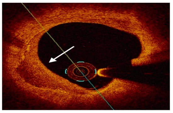 Ijms 24 05155 g005 550