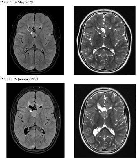 Jcm 12 00956 g004b 550