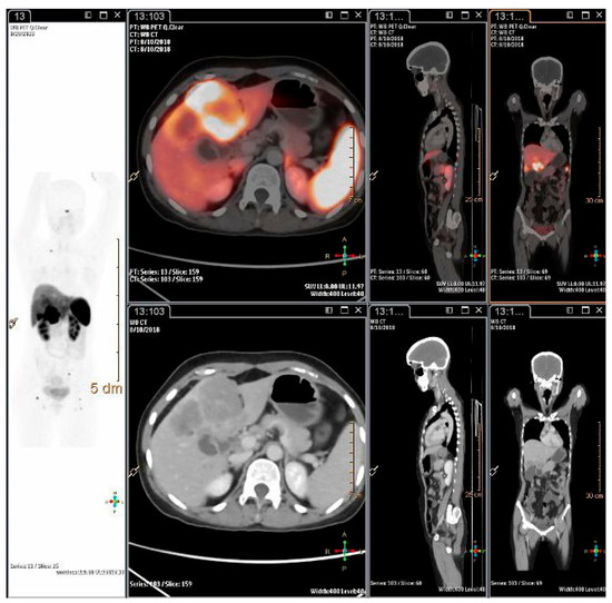 Diagnostics 13 02154 g002 550