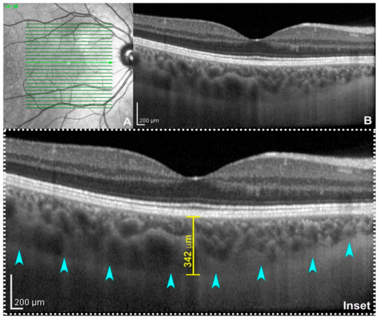 Tomography 09 00116 g001 550