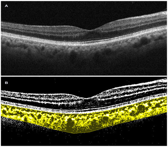 Tomography 09 00116 g002 550