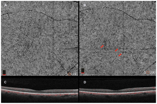 Tomography 09 00116 g003 550