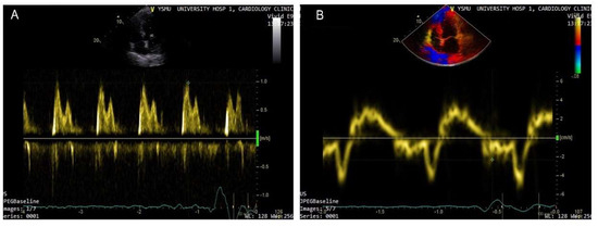 Diagnostics 13 02553 g001 550