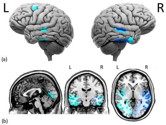 Brainsci 13 01399 g001