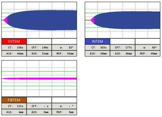 Diagnostics 13 03219 g007