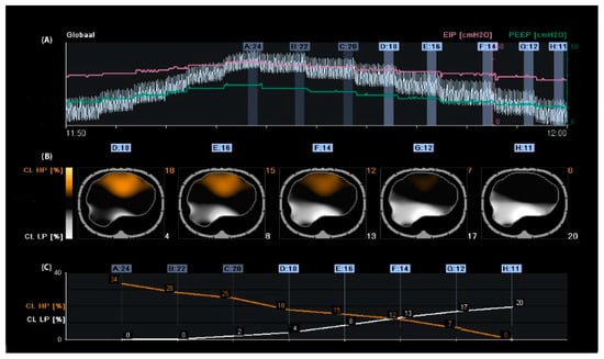 Tomography 09 00150 g001