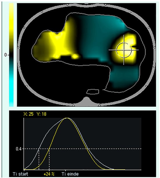 Tomography 09 00150 g005