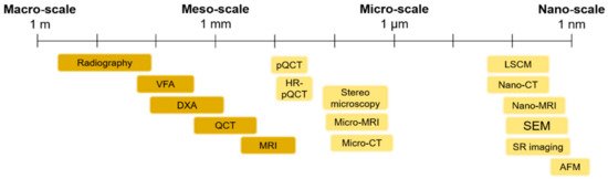 Macro Scale