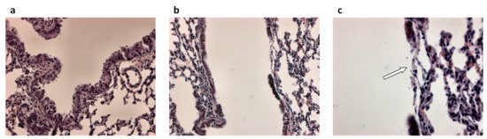 Pathophysiology 28 00011 g001 550