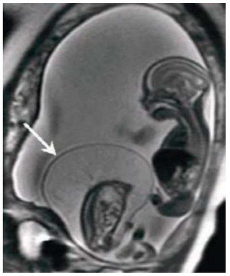 Diagnostica 11 00445 g001 550