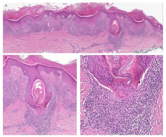 Dermatopathology 08 00020 g001 550