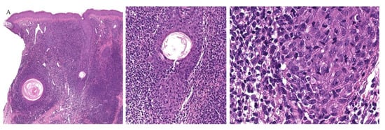 Dermatopathology 08 00020 g010 550