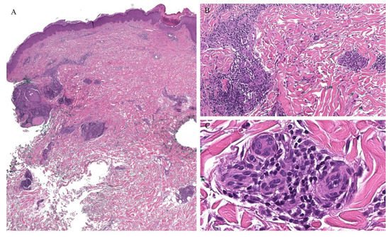 Dermatopathology 08 00020 g011 550