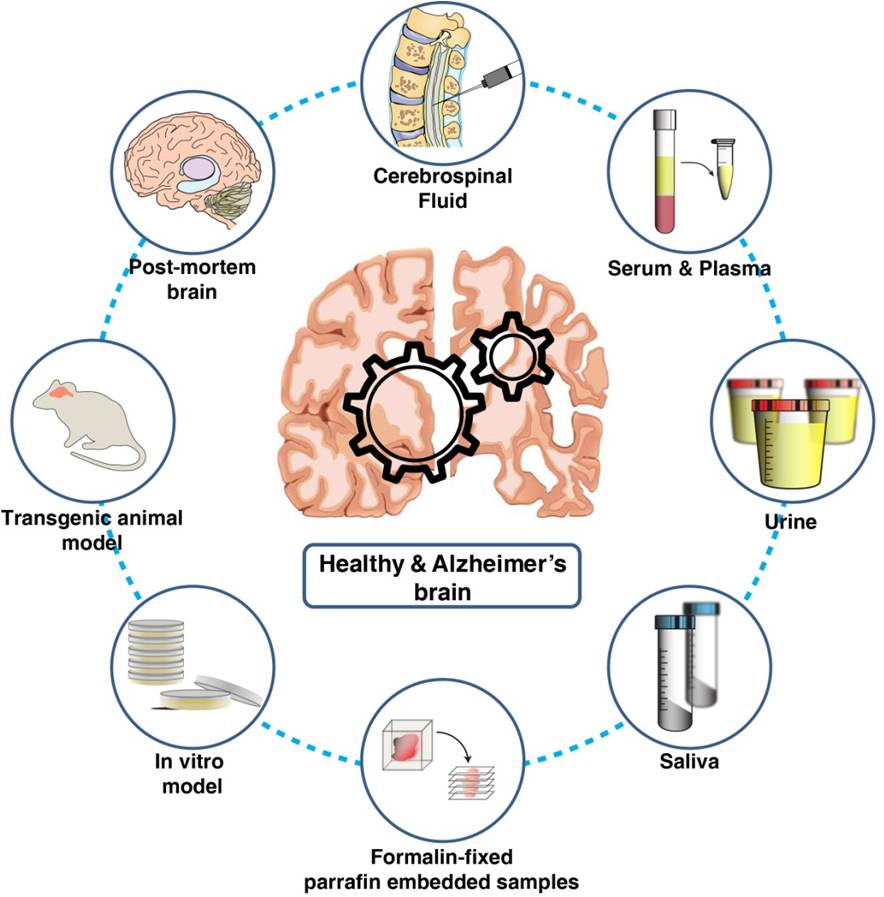 Proteomics Landscape of Alzheimer's Disease | Encyclopedia MDPI