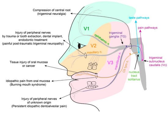 oral-mucosal-pain-encyclopedia-mdpi