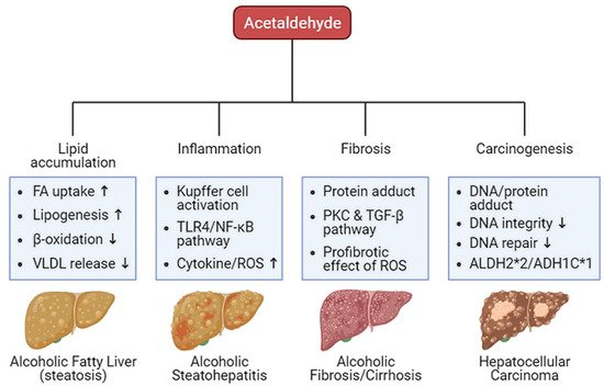 Alcoholic Liver Cirrhosis