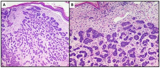 Dermatopathology 08 00032 g003 550