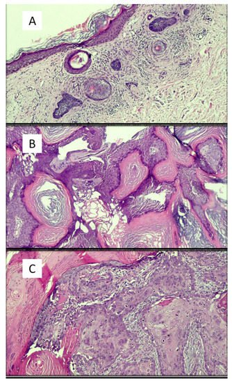 Dermatopathology 08 00044 g002a 550