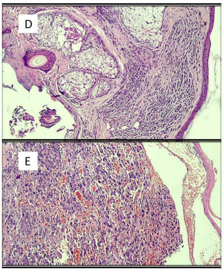 Dermatopathology 08 00044 g002b 550