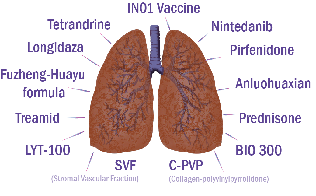 Clinical Trials of Therapies for Post-COVID Lung Fibrosis