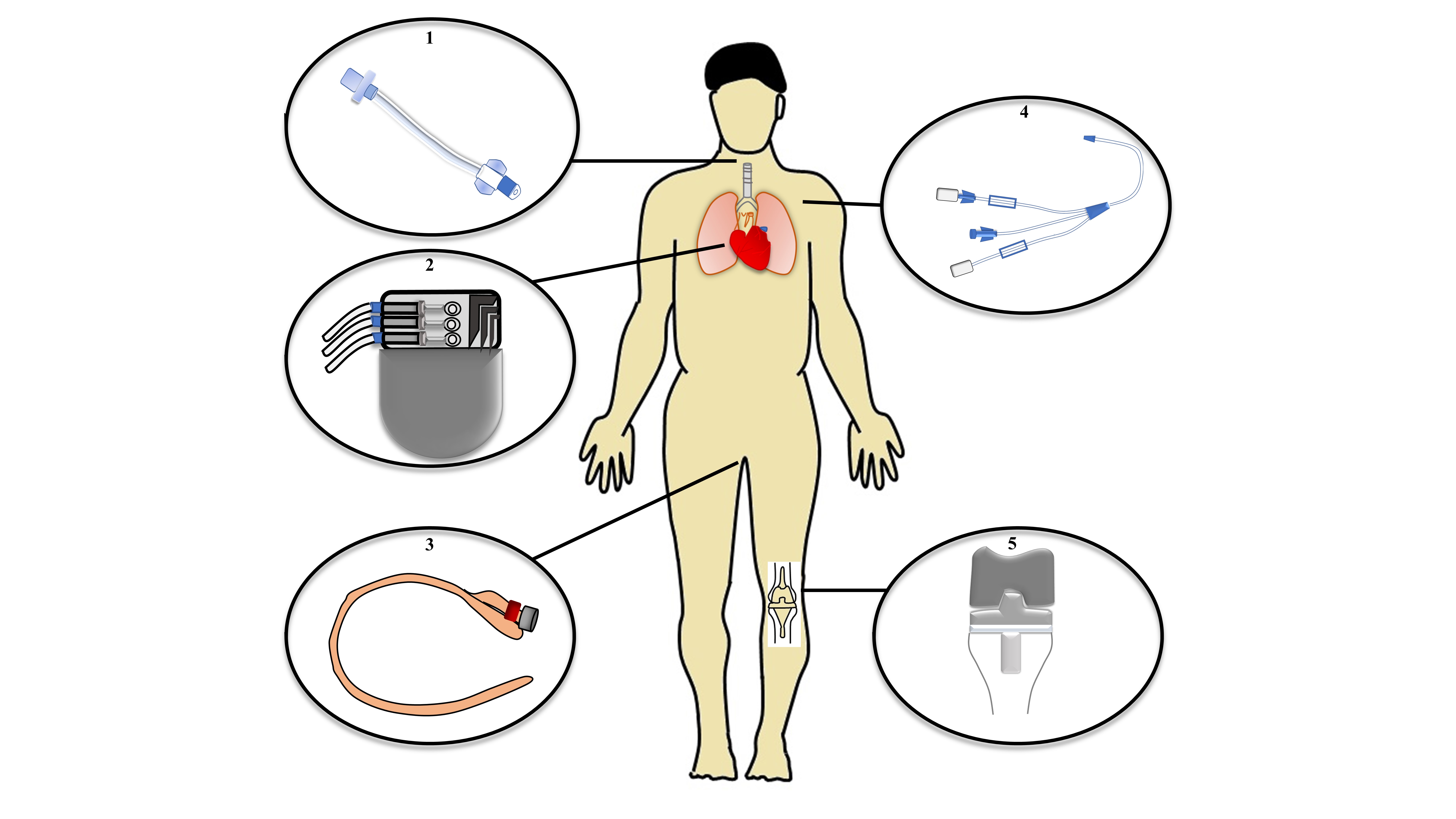 Device associated infection