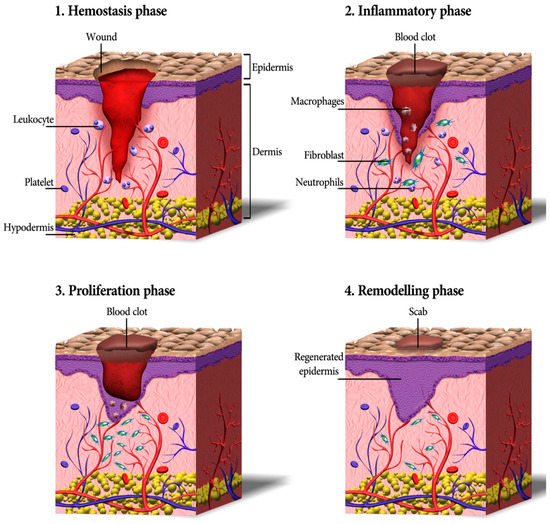 Cell-Based Therapeutic Strategies for Skin Replacement | Encyclopedia MDPI