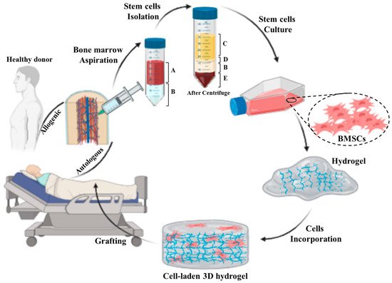 Cell-Based Therapeutic Strategies for Skin Replacement | Encyclopedia MDPI