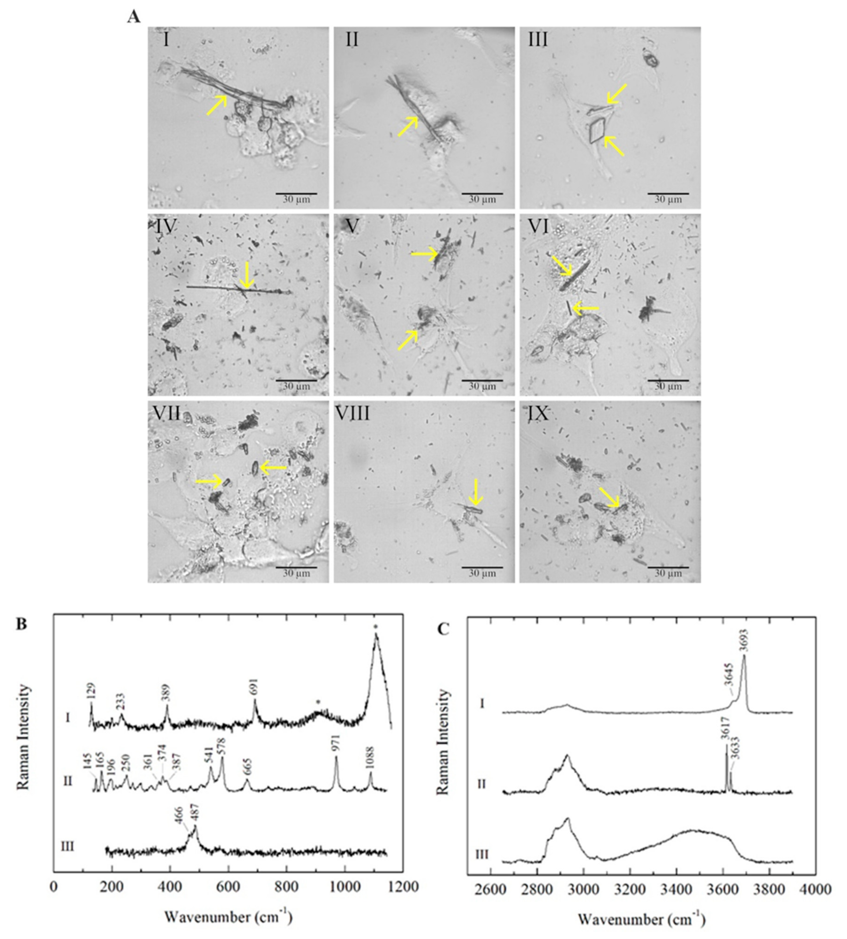 Ijms 23 02840 g001