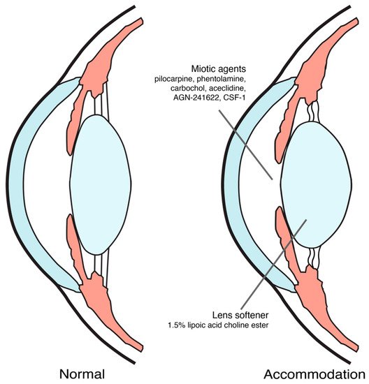 Jcm 11 01385 g001 550