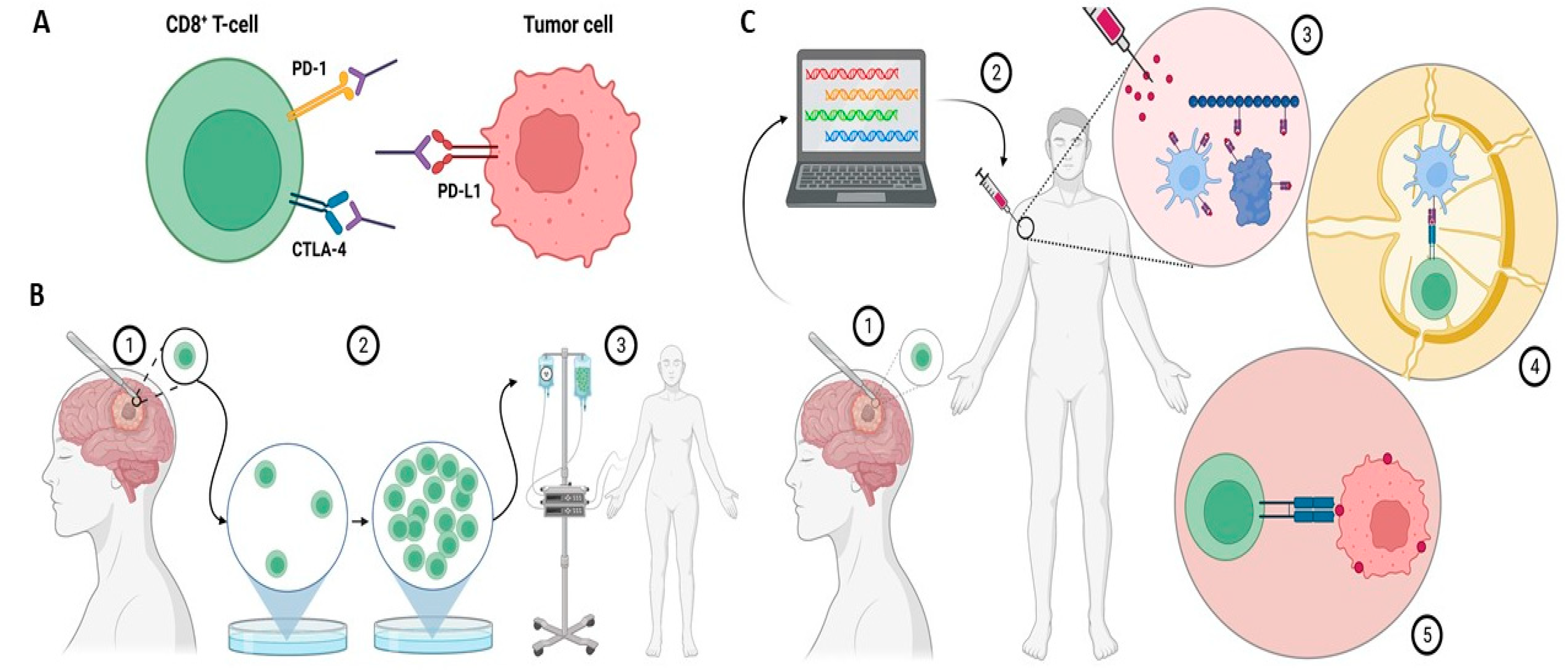 Immunotherapy For Adult Glioblastoma | Encyclopedia MDPI