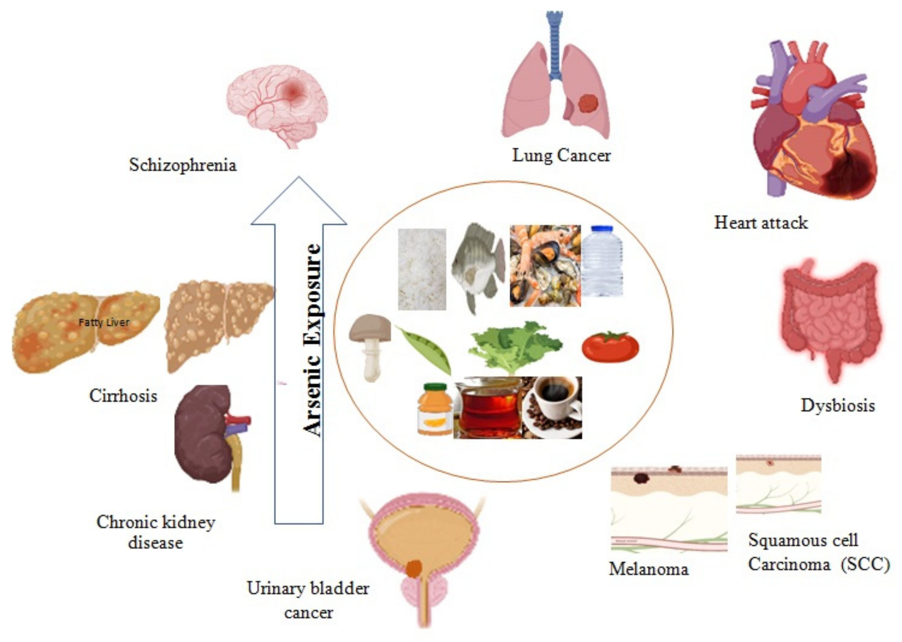 arsenic-induced-health-hazards-encyclopedia-mdpi