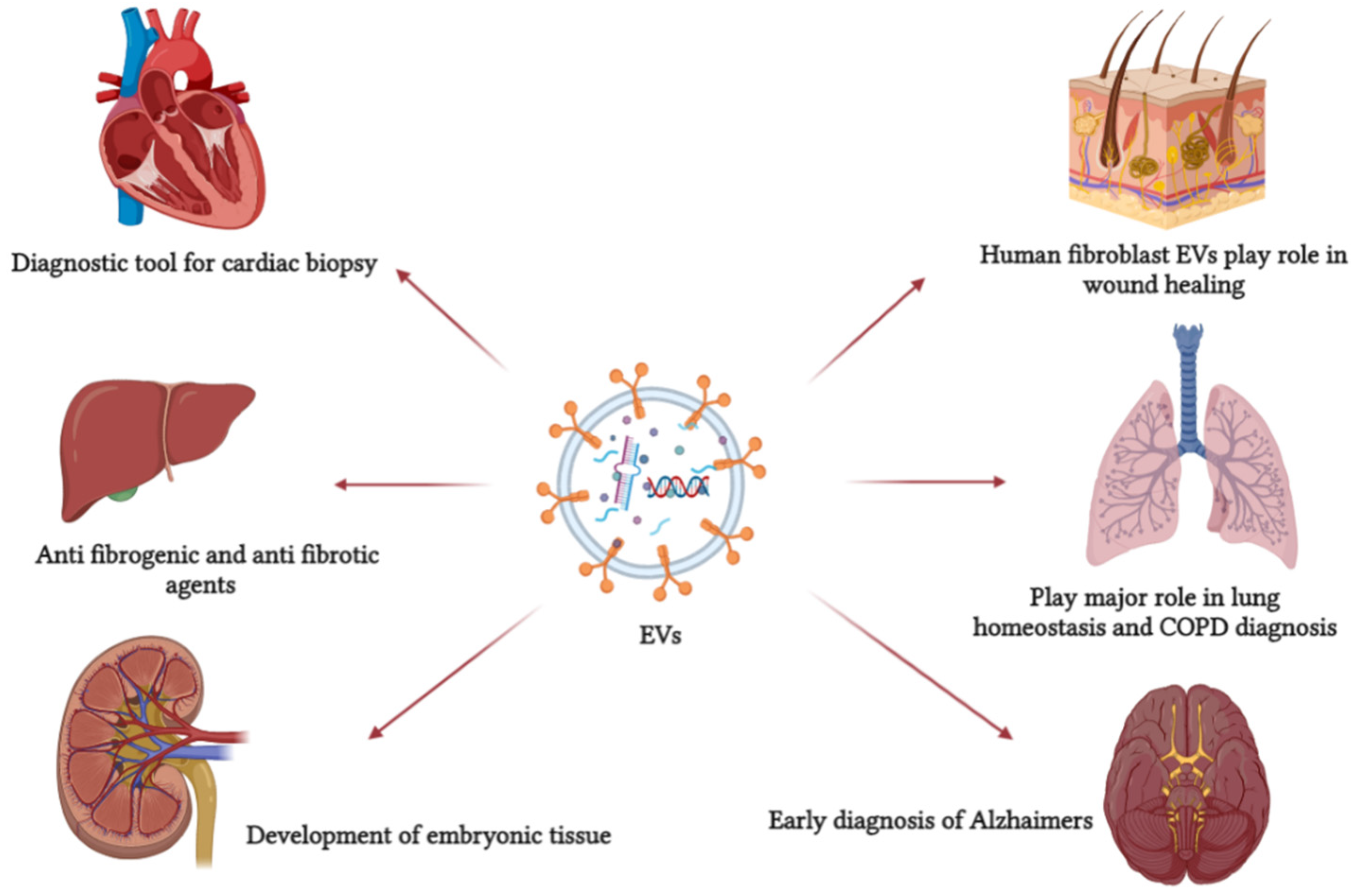 Extracellular Vesicles As Drug Delivery Agent 