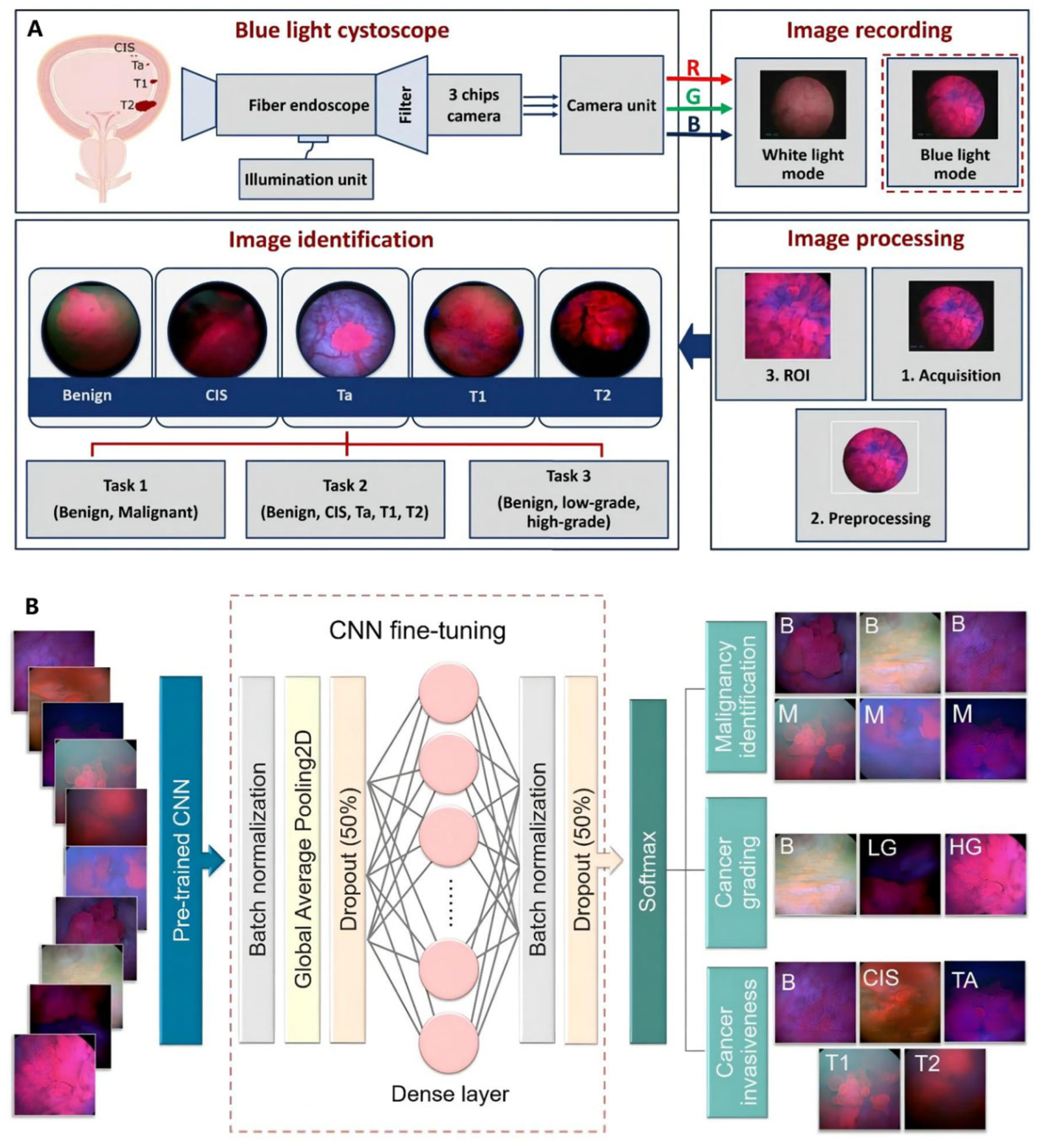 Diagnosis for Bladder Cancer | Encyclopedia MDPI