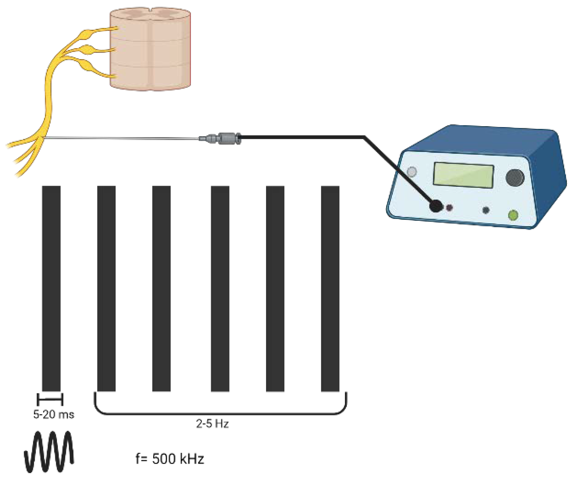 The Mechanisms of Action of Pulsed Radiofrequency Encyclopedia MDPI