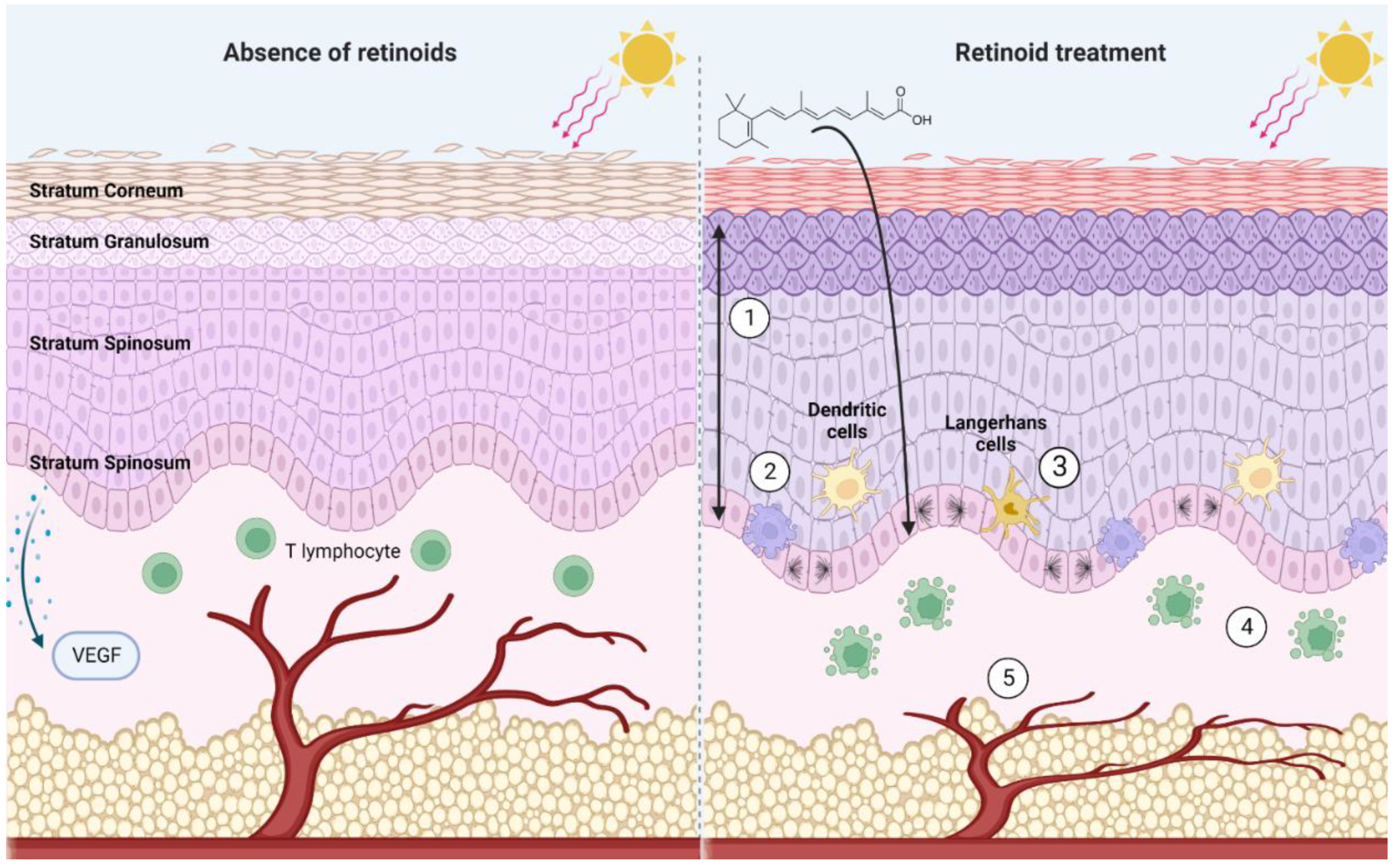 The Biological Effects Of Retinoids In The Skin Encyclopedia MDPI The Biological Effects Of Retinoids In The Skin Encyclopedia MDPI