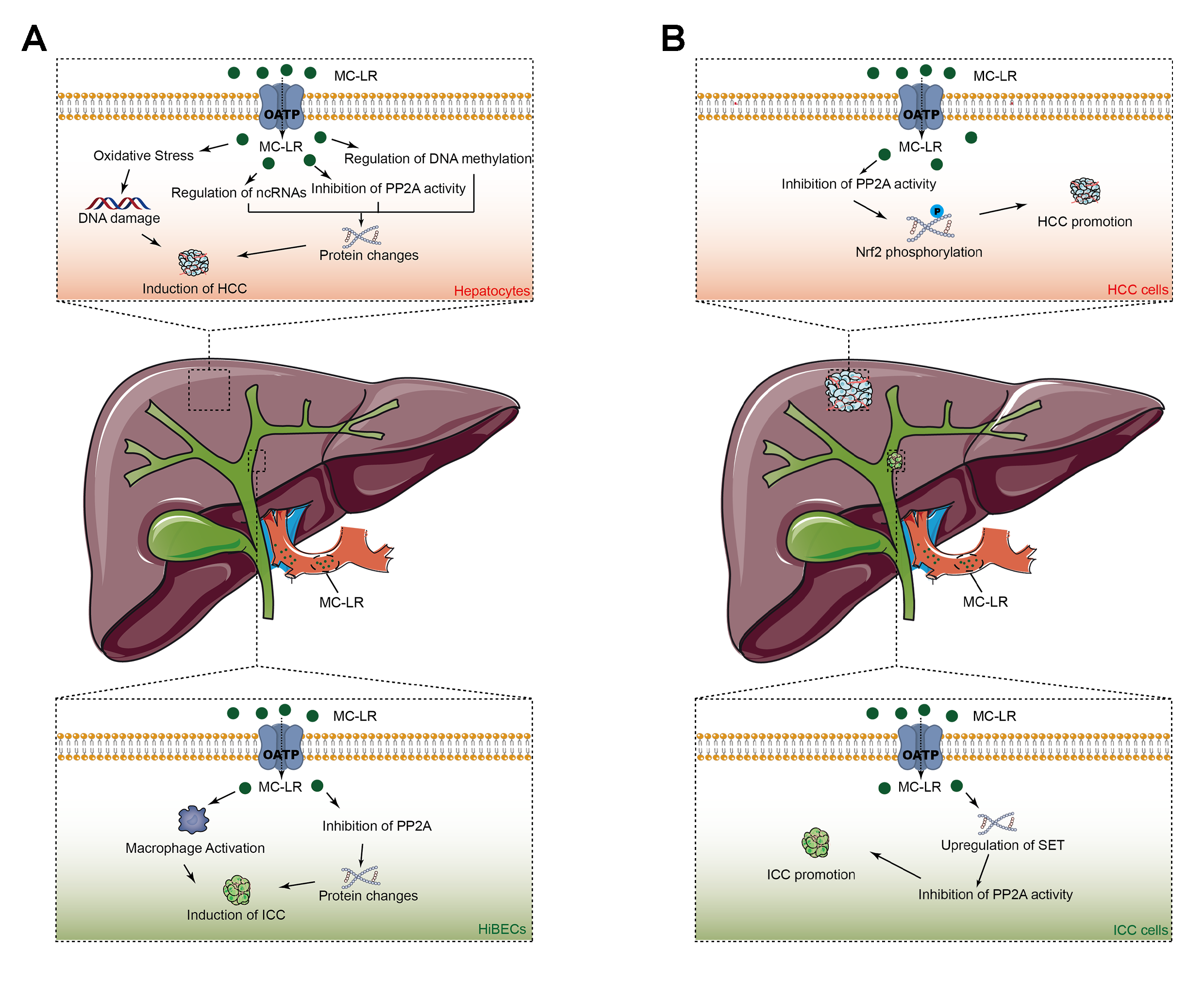 Figure 3. Schematic diagram of the possible molecular mechanisms underlying microcystin-LR-induced carcinogenesis (A) and tumor progression (B) of primary liver cancers. Abbreviation: HCC: hepatocellular carcinoma, ICC: intrahe-patic cholangiocarcinoma, OATP: organic anion transport polypeptide, PP2A: protein phosphatase 2 A.