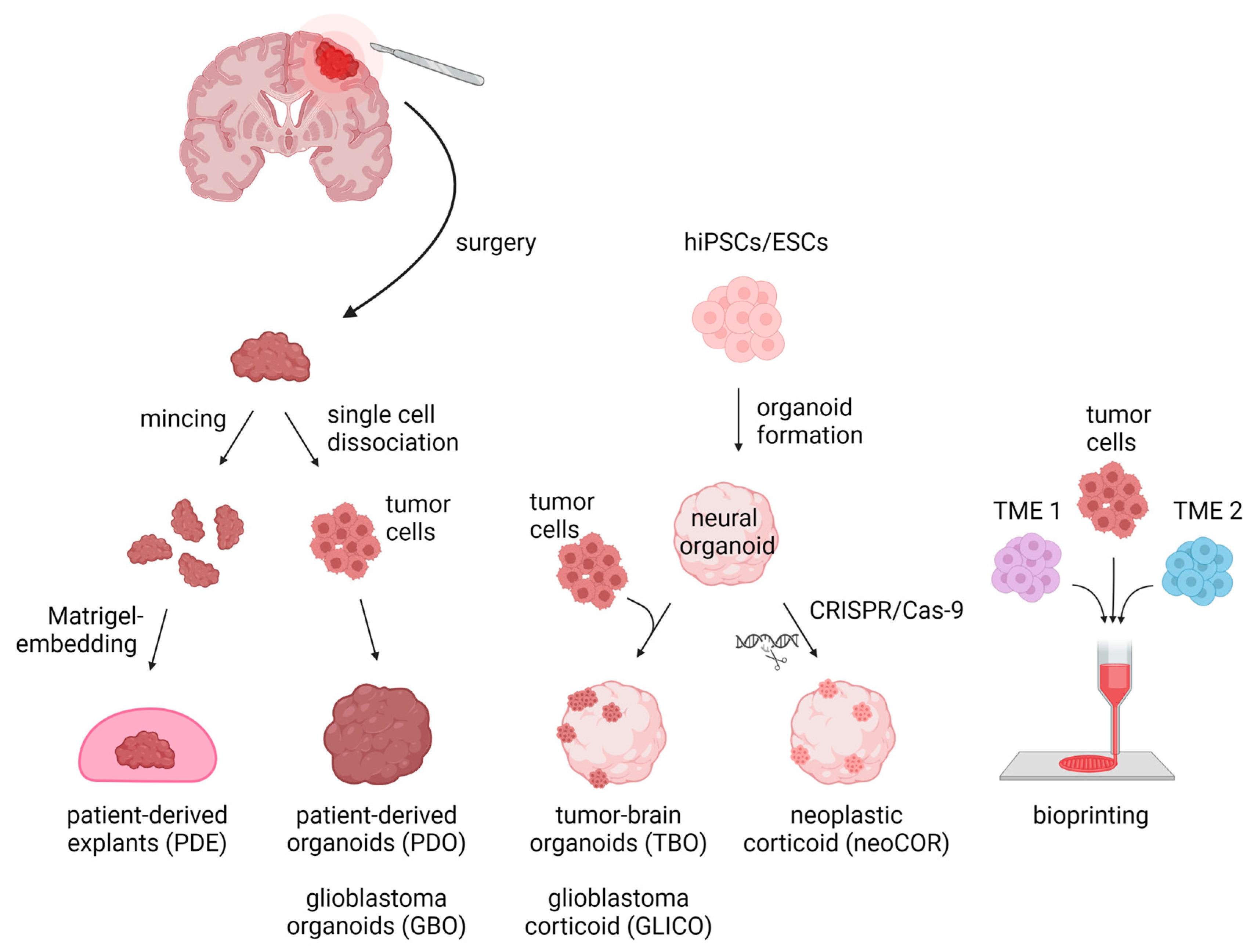 Organoids in Pediatric Brain Tumor Precision Medicine | Encyclopedia MDPI