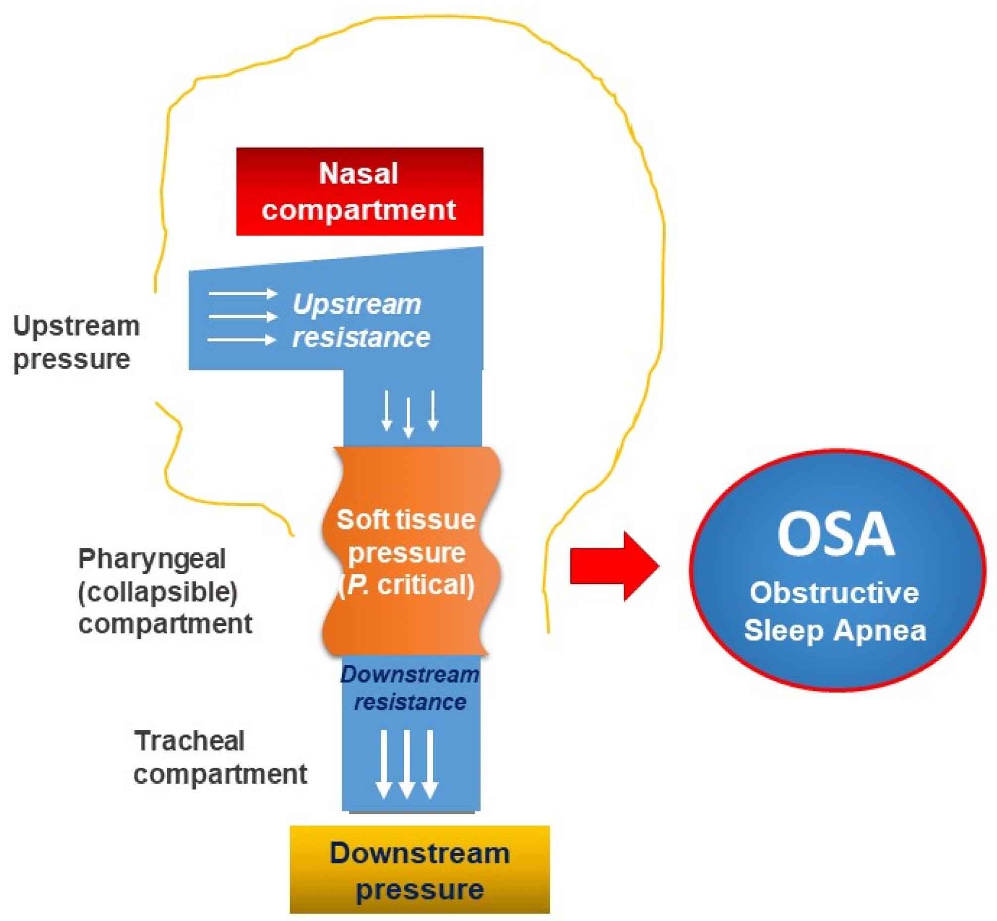Management Of Obstructive Sleep Apnea With Comorbidities Encyclopedia