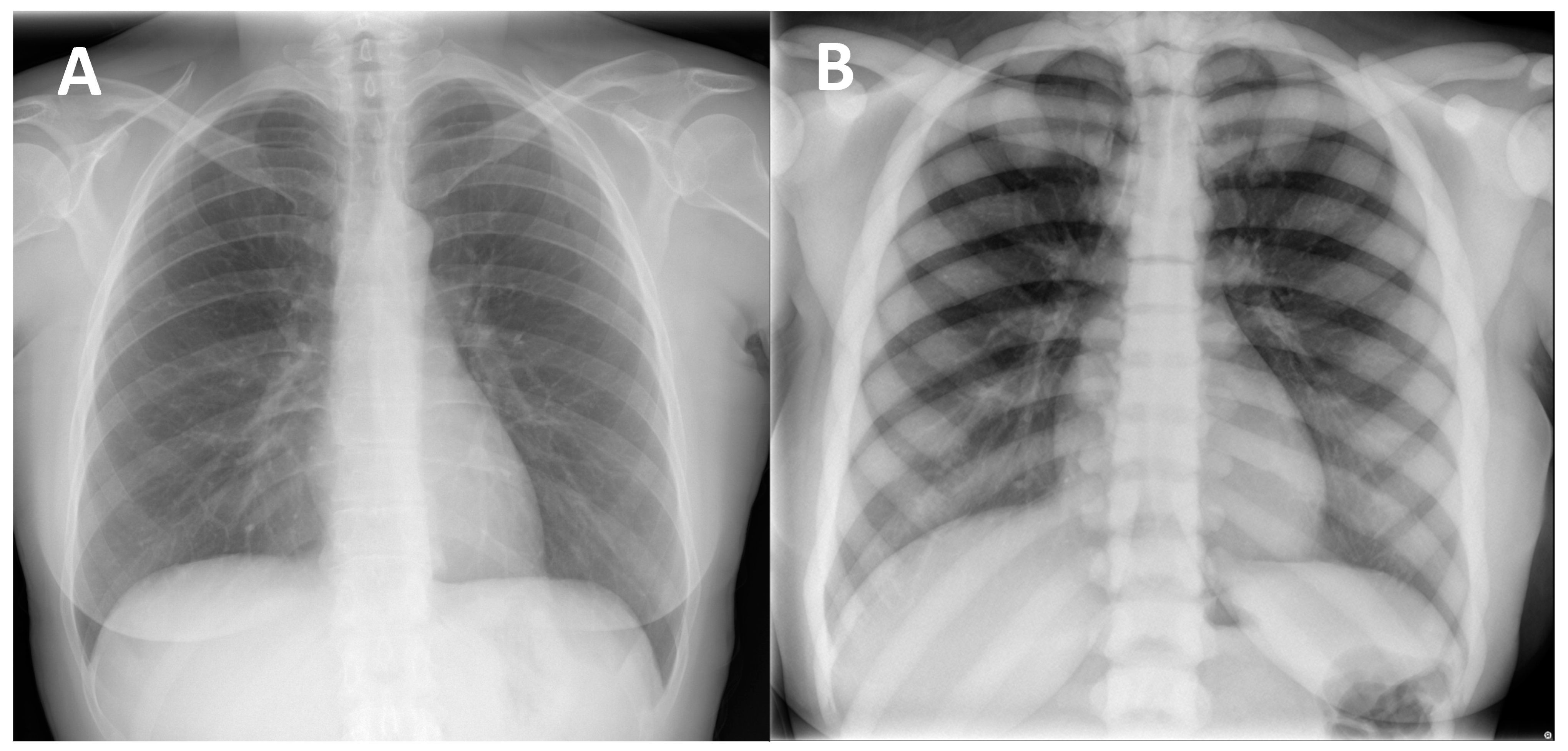 Genes 13 01965 g001