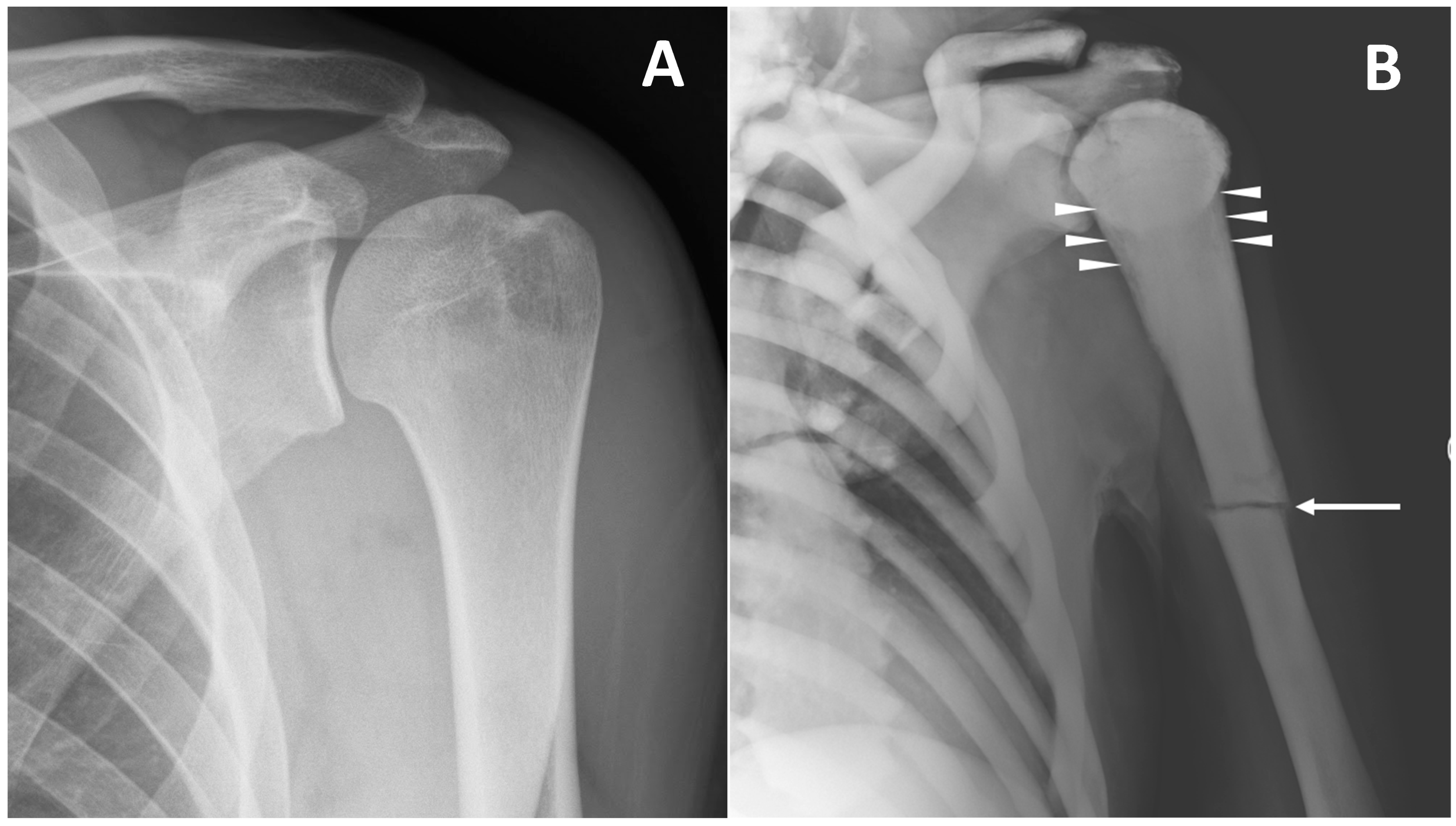 Skeletal Imaging Features in Osteopetrosis | Encyclopedia MDPI